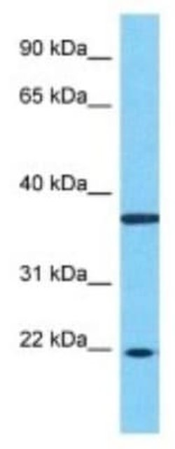 ZNF726 Rabbit anti-Human, Polyclonal, Novus Biologicals:Antibodies:Primary